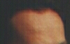 My brain